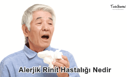 Alerjik Rinit Hastalığı Nedir TEDAVİSİ