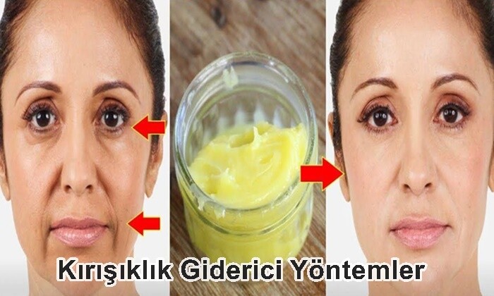 Kırışıklık Giderici Yöntemler