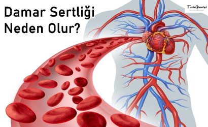 Damar Sertliği Neden Olur