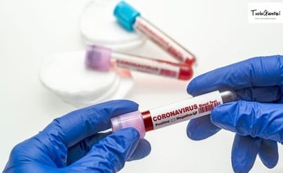 Kovid 19 güncel Verileri 04-04-2021