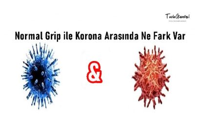 Normal Grip ile Korona Arasında Ne Fark Var