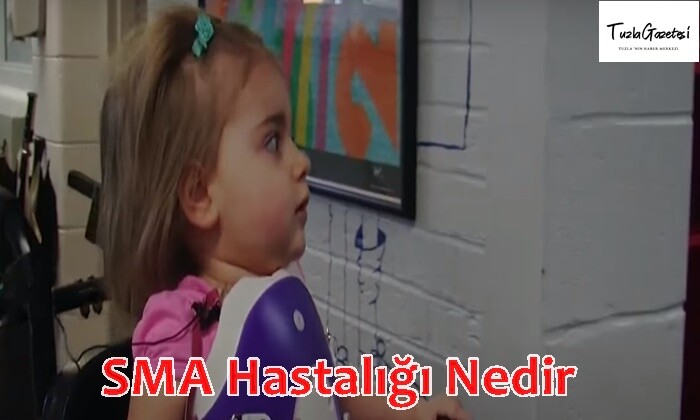 SMA Hastalığı Nedir