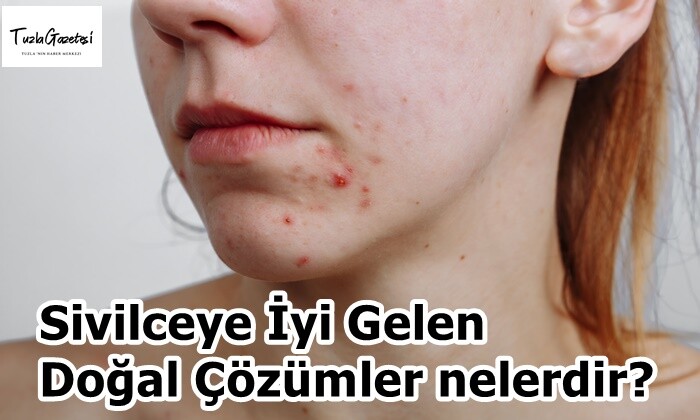 Sivilceye İyi Gelen Doğal Çözümler