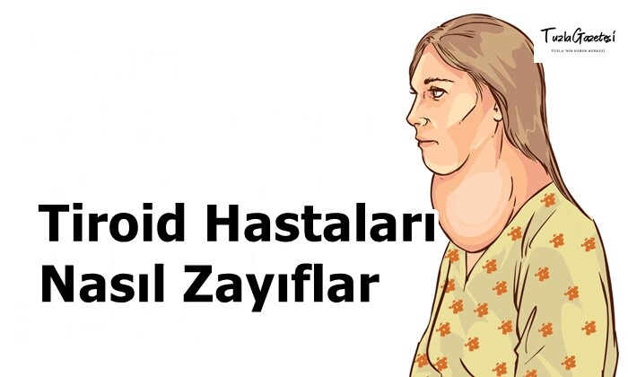 Tiroid Hastaları Nasıl Zayıflar?