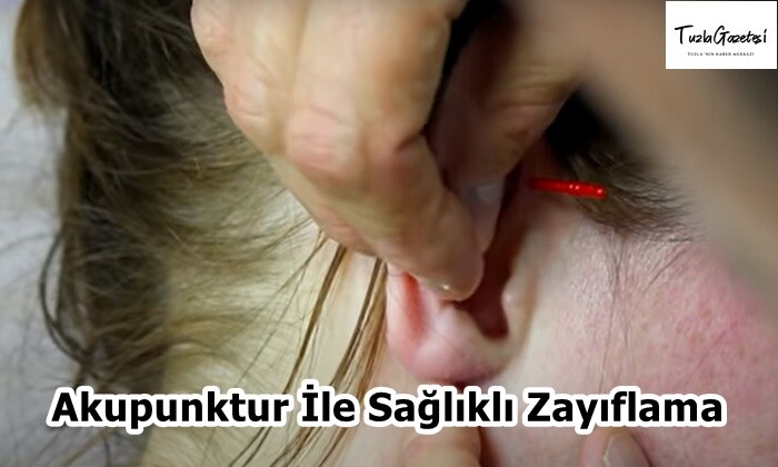 Akupunktur İle Sağlıklı Zayıflama