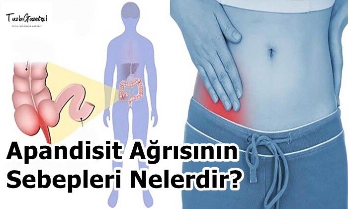 Apandisit Ağrısının Sebepleri Nelerdir