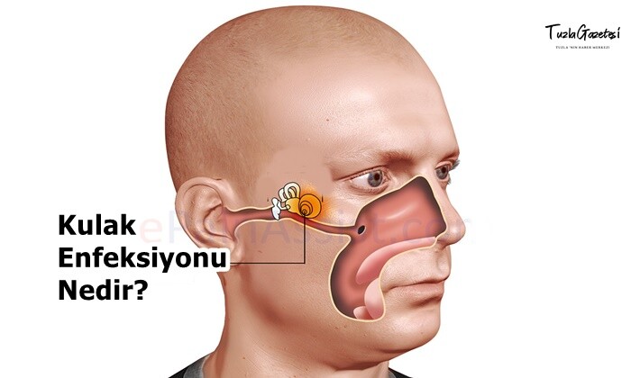 Kulak Enfeksiyonu Nedir?