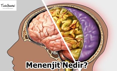 Menenjit Nedir