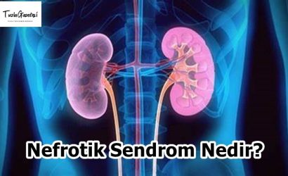 Nefrotik Sendrom Nedir