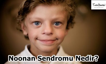 Noonan Sendromu Nedir