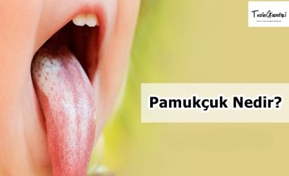 Pamukçuk Nedir nedenleri