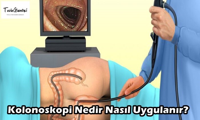 Kolonoskopi Nedir Nasıl Uygulanır