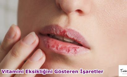 B6 Vitamini Eksikliğini Gösteren İşaretler