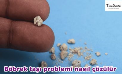 Böbrek taşı problemi nasıl çözülür