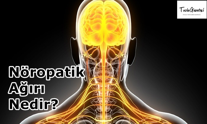 Nöropatik Ağırı Nedir?