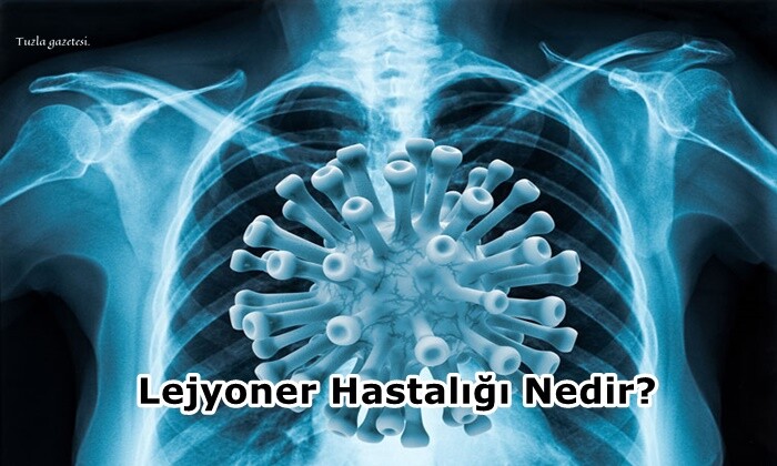 Lejyoner Hastalığı Nedir