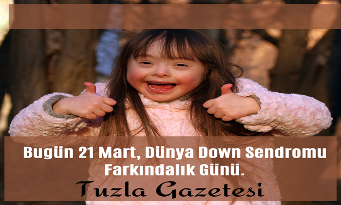 Bugün 21 Mart, Dünya Down Sendromu Farkındalık Günü