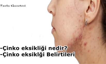 Çinko eksikliği nedir?